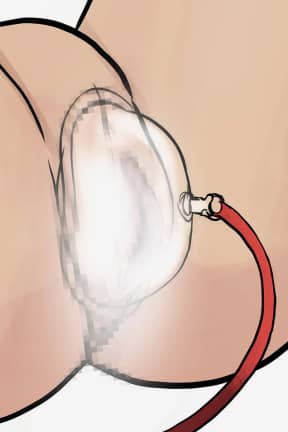 Klitorispumpar / Vaginapumpar Temptasia Advanced Pussy Pump System